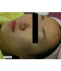전후사진