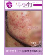 전후사진
