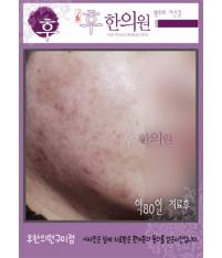전후사진