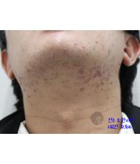 전후사진