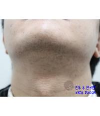 전후사진