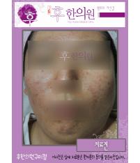 전후사진