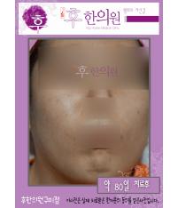 전후사진
