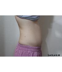 전후사진