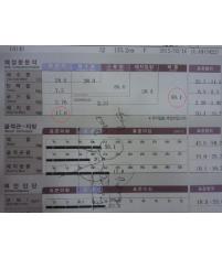 전후사진