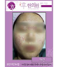 전후사진