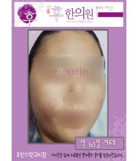 전후사진