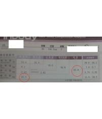 전후사진
