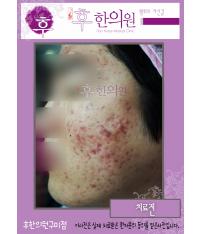전후사진