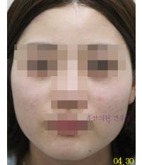 전후사진