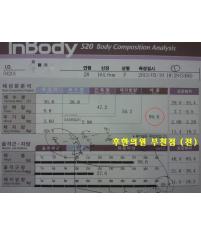 전후사진