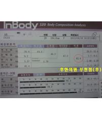 전후사진