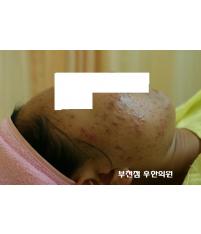 전후사진
