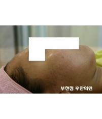 전후사진