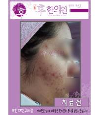 전후사진