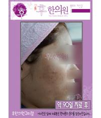전후사진