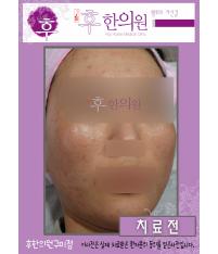 전후사진