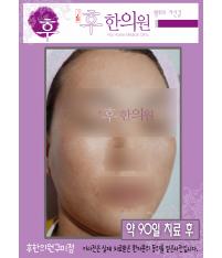 전후사진