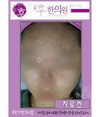 전후사진