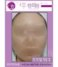 전후사진