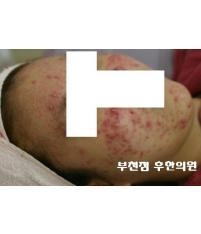 전후사진
