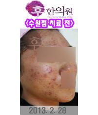 전후사진