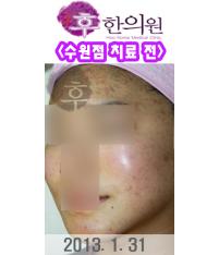 전후사진