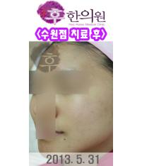전후사진