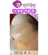 전후사진