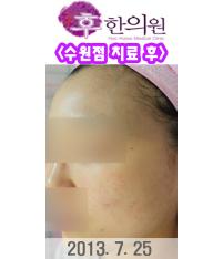 전후사진