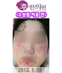 전후사진