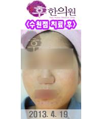 전후사진