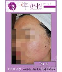전후사진