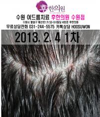 전후사진