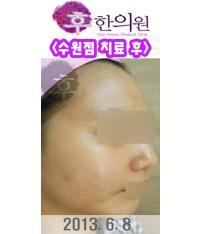 전후사진