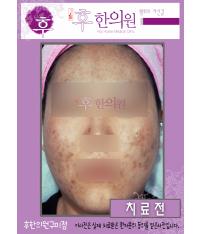 전후사진