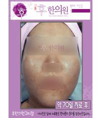 전후사진
