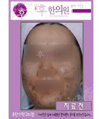 전후사진