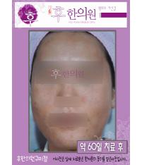 전후사진