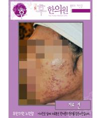 전후사진