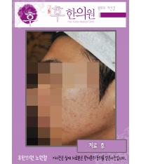 전후사진