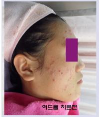 전후사진