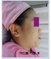 전후사진