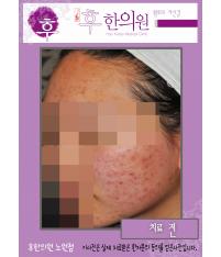 전후사진