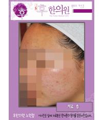 전후사진