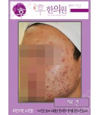 전후사진