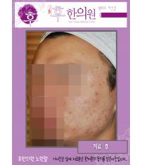 전후사진