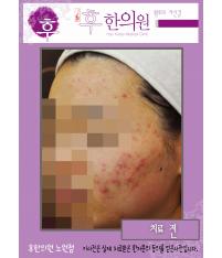 전후사진
