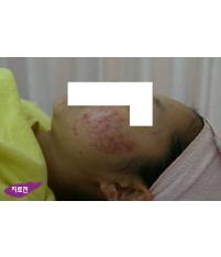 전후사진