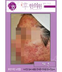 전후사진